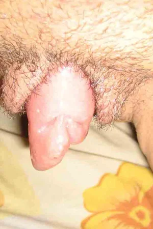 Gorgeous Compilation of Big Clits — photo 35