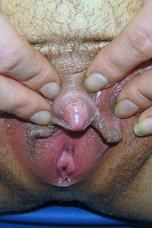 Gostosas mostrando bucetas em close e clitóris grandes — foto 52