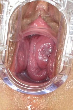 Brincando com espéculo vaginal — foto 12