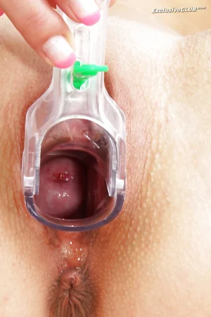 Brincando com espéculo vaginal — foto 6